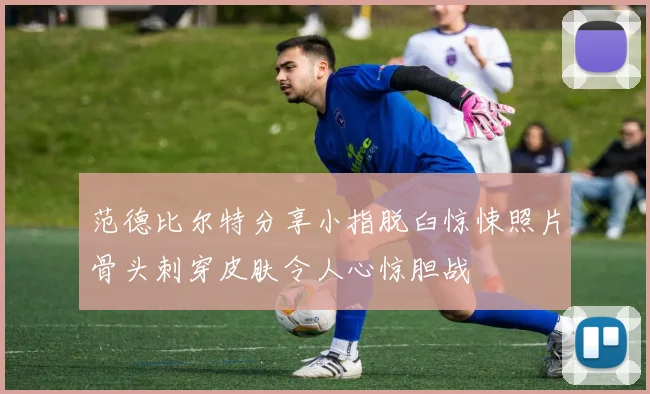 范德比尔特分享小指脱臼惊悚照片骨头刺穿皮肤令人心惊胆战